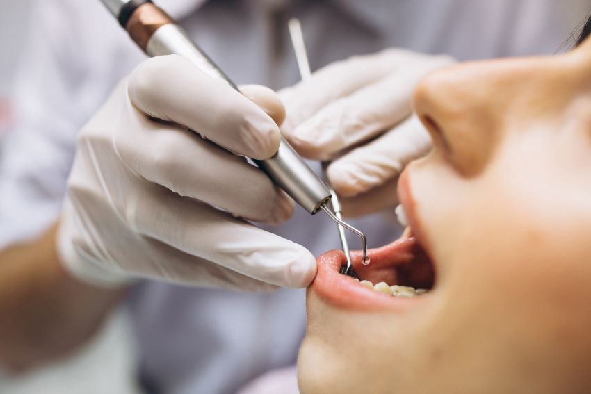 ¿Cuándo es necesario el injerto de hueso dental?